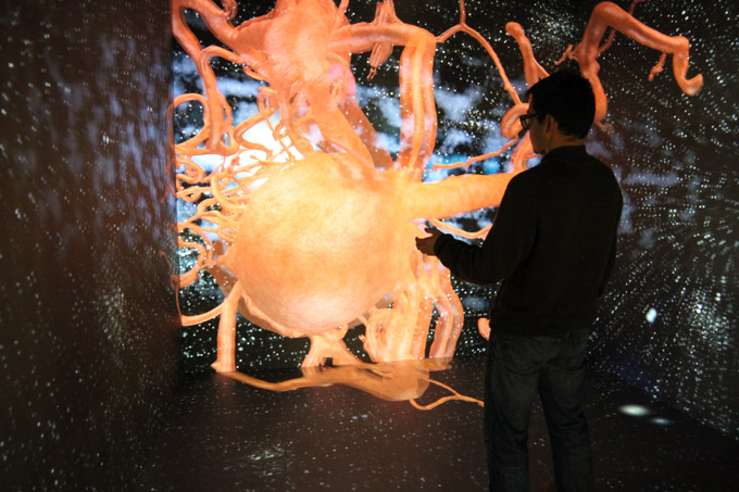 Cave Aneurysm