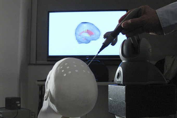 Prototype